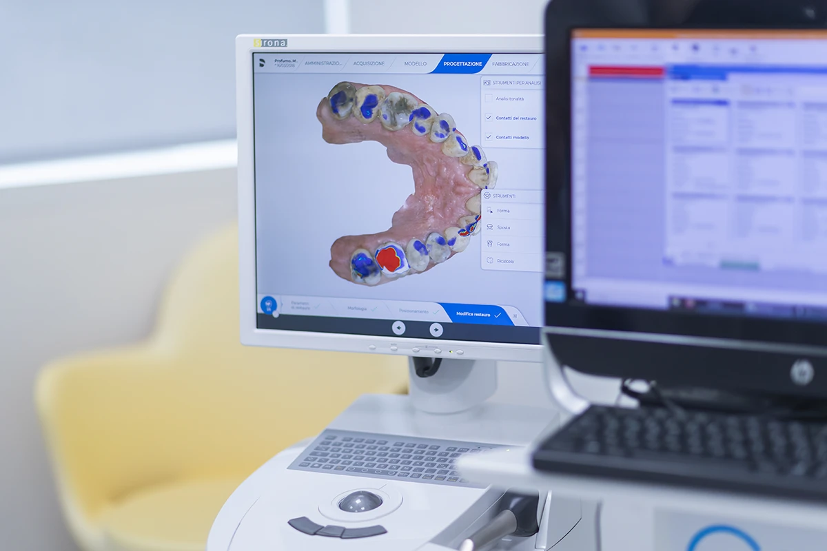Scanner 
                dentale che ricostruisce un'immagine 3D dell'arcata dentale, mostrando dettagli anatomici e strutturali.